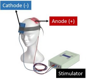 دستگاه tdcs